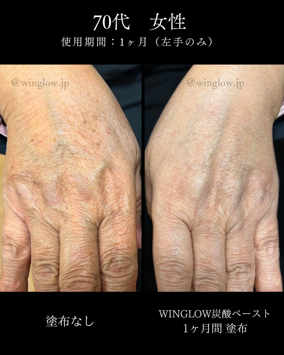 WINGLOW®︎(ウィングロウ)炭酸ペースト